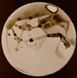Marss - Antoniadi